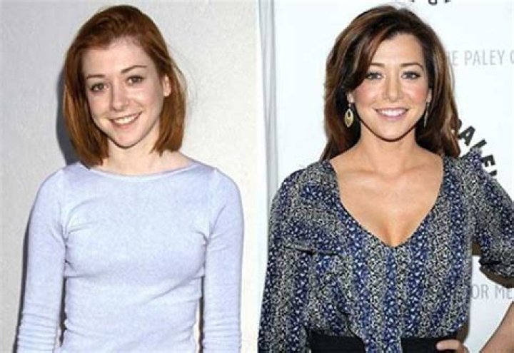 Alyson Hannigan Plastic Surgery Before and After