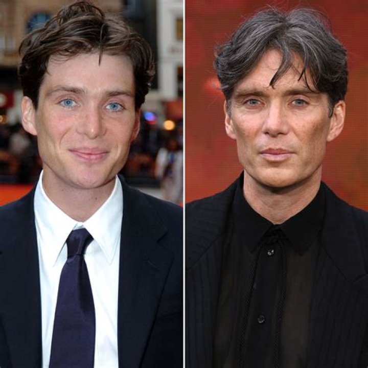 Cillian Murphy Plastic Surgery: Murphy's Static Look Credited To?