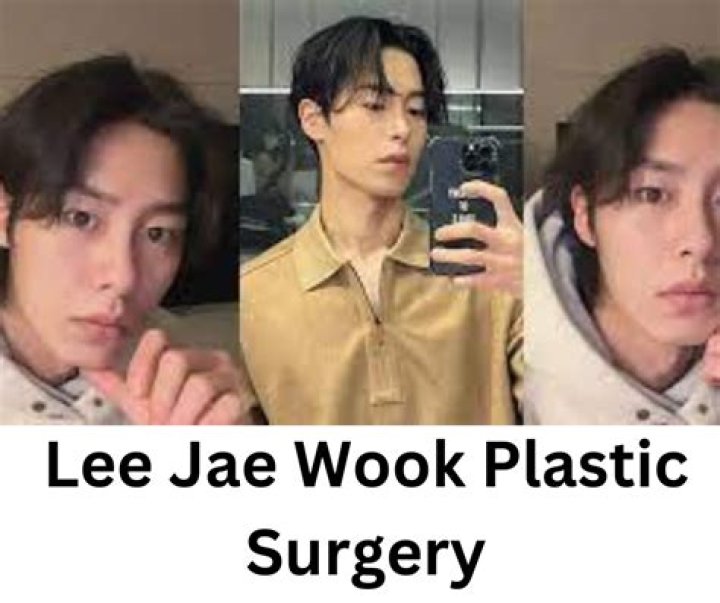 Lee Jae Wook Plastic Surgery: Exploring the Truth Behind Celebrity Speculations