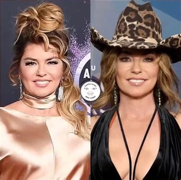 Shania Twain Plastic Surgery: Her Approach of Embracing or Altering Herself?